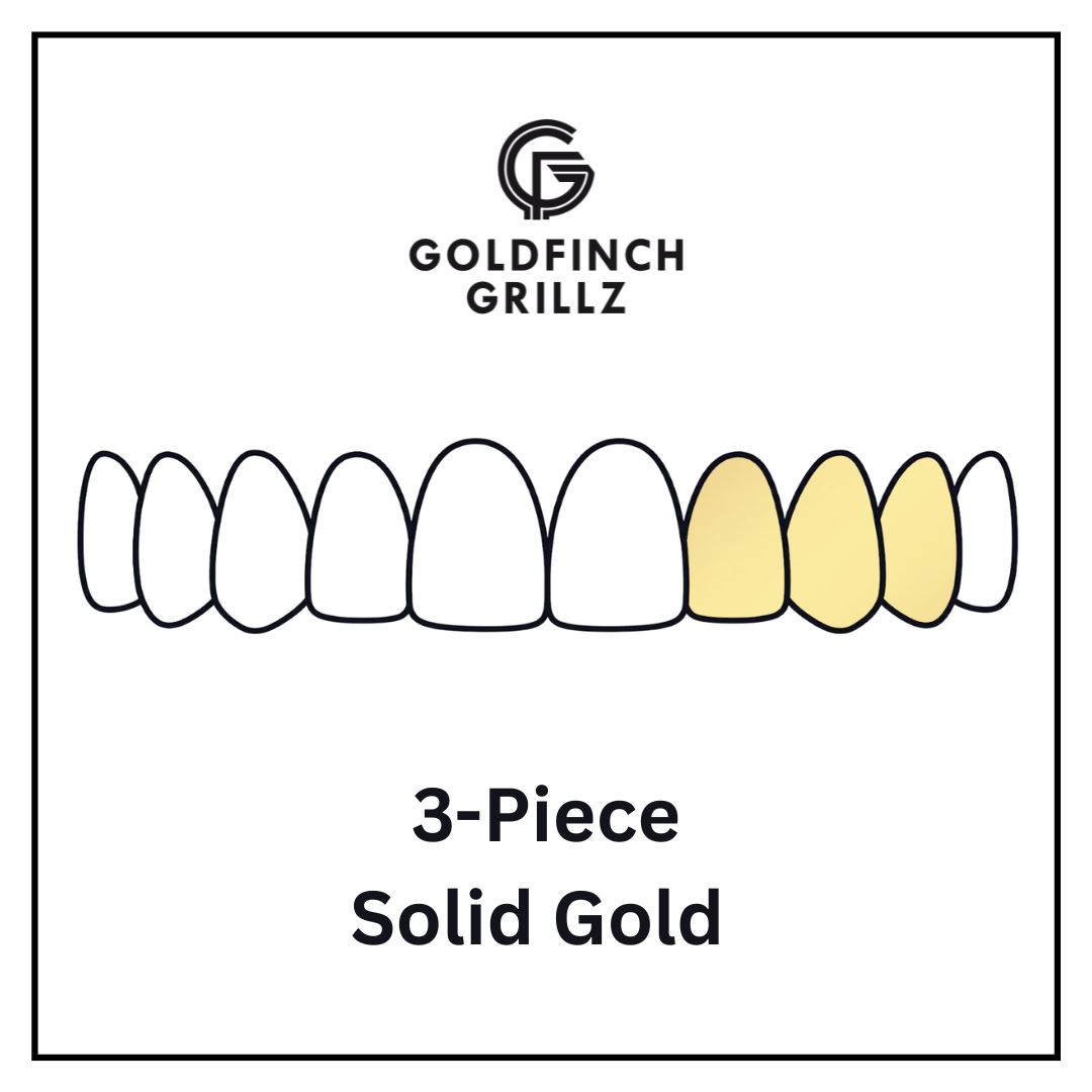 3-Piece - Solid Gold