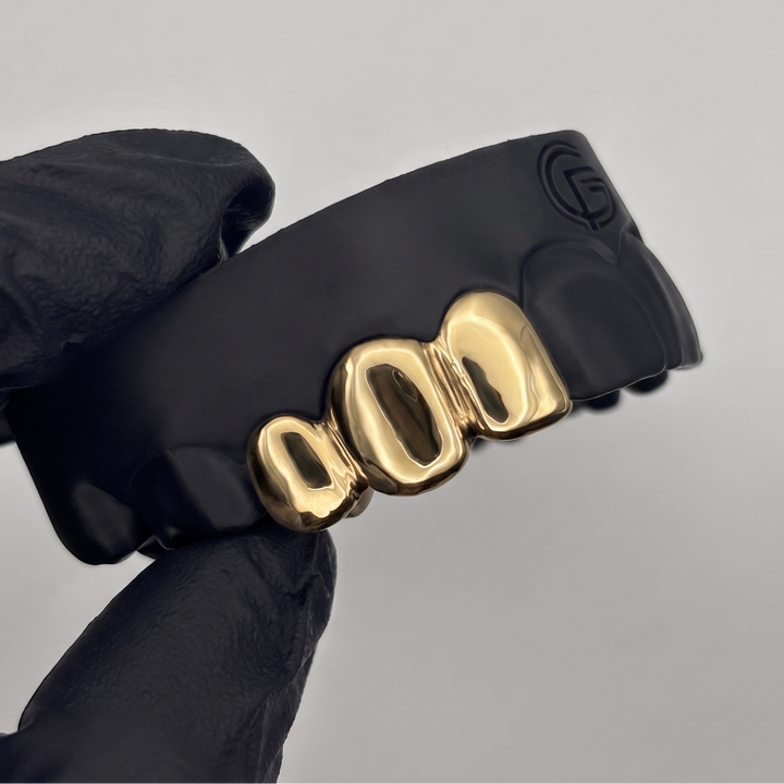 Custom 3 piece solid gold grillz set handcrafted in New Zealand