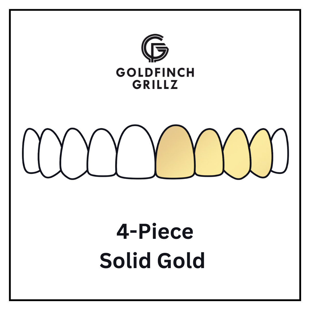 4-Piece - Solid Gold
