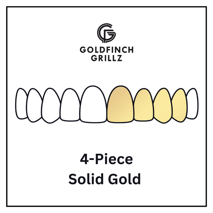 4-Piece - Solid Gold