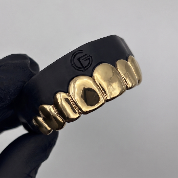 Custom 8 piece solid gold grillz set handcrafted in New Zealand