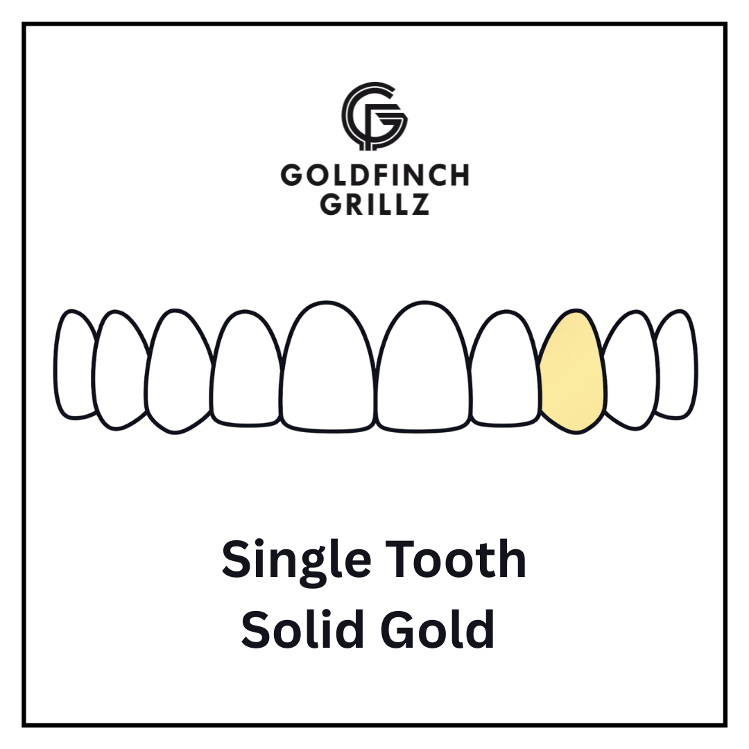 Single tooth - Solid Gold