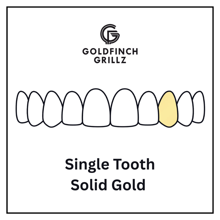 Single tooth - Solid Gold